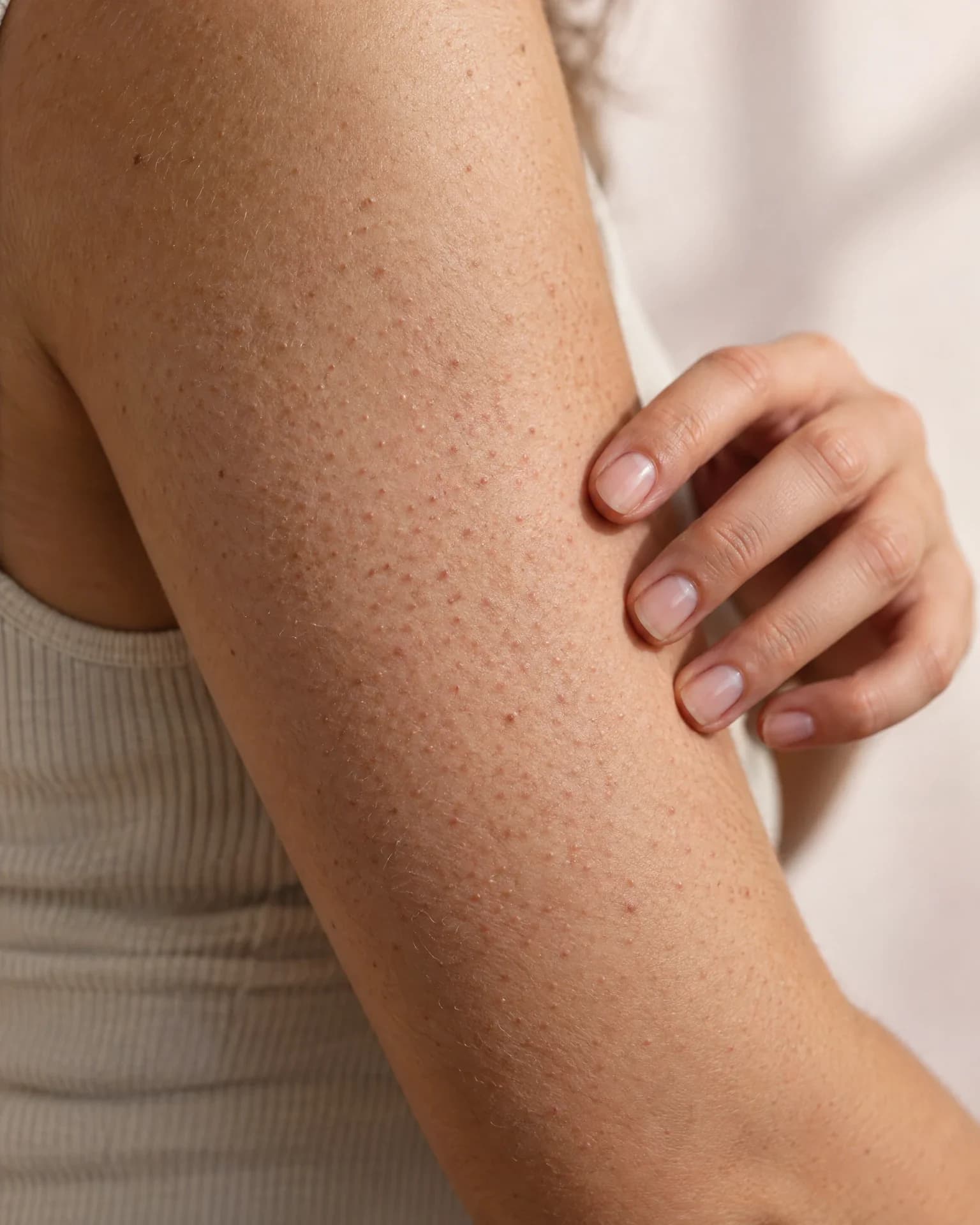 Close-up of rough, bumpy strawberry skin on the back of an upper arm